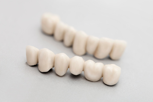 porcelanowe mosty zębowe